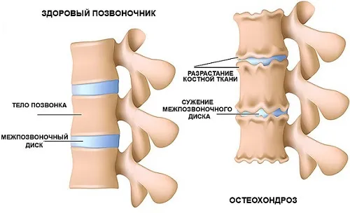 лікувати болять суглоби