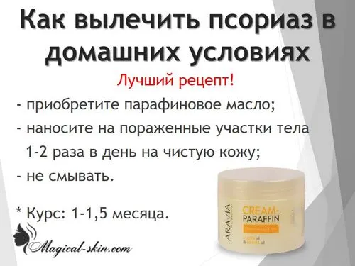 псоріаз нога лікувати фото