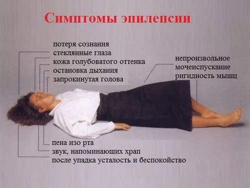як лікувати епілепсію у дорослих