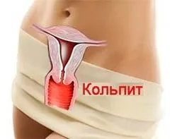 як лікувати вікової кольпіт