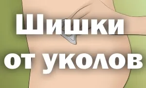 як швидко лікувати забій сідниці