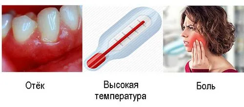 ускладнення після розрізу ясна