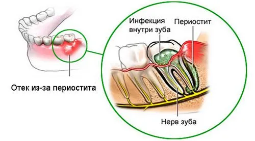 ускладнення після розрізу ясна