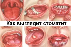 дантист будинку