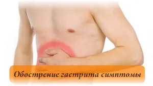 як лікувати гастрит загострення