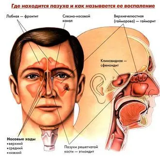 Синусит лікування народними засобами ніж лікувати синусит народними засобами
