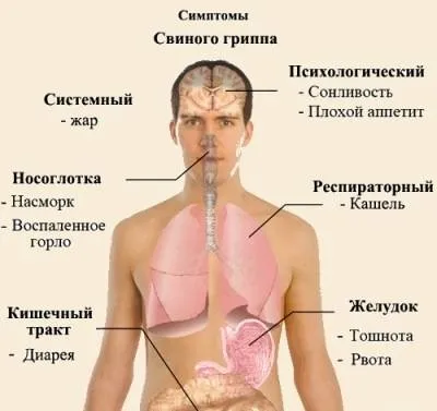 як лікувати свинячий грип