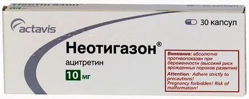 лікувати псоріаз ліки