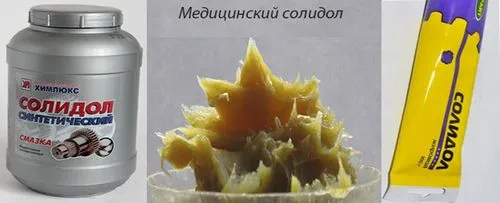 як лікувати псоріаз солідолом