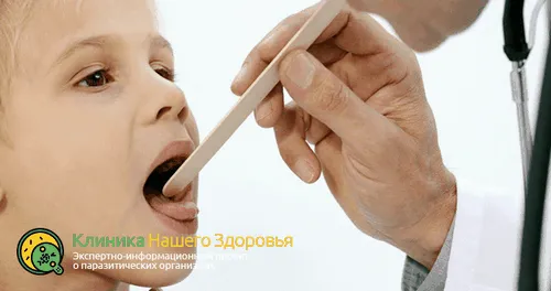 Симптоми і лікування опісторхозу у дітей: ефективні методи і народна медицина як лікувати опісторхоз у дитини