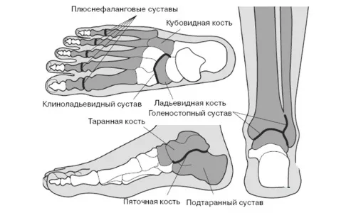 як лікувати розтягнення великого пальця ноги