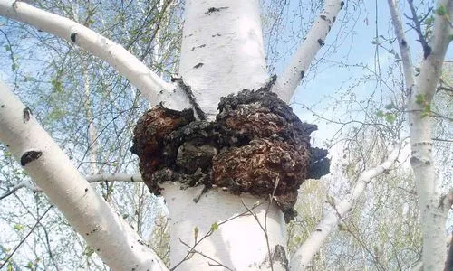 як лікувати чоловічу мастопатію