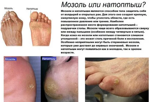 рецепти