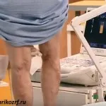 як лікувати варикоз і тромбофлебіт