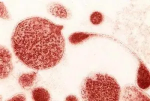 як лікувати уреаплазмоз при вагітності