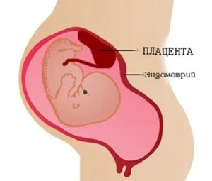 патологія