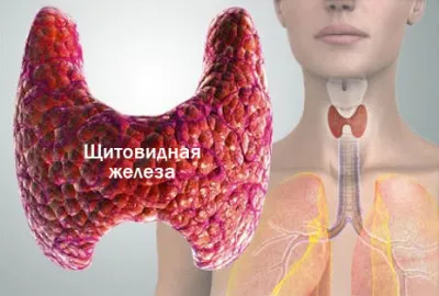 вилікувати вузловий зоб