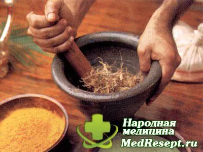 трихомоніаз симптоми