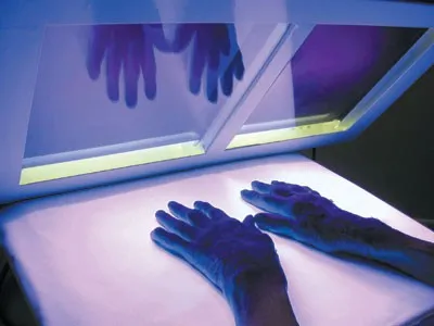 як лікувати псоріаз кварцовою лампою