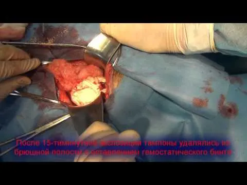 як лікувати печінку після удару