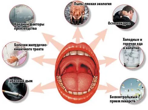 як лікувати бактеріальний тонзиліт