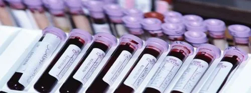 Ттг при плануванні вагітності дефіцит йоду і зачаття