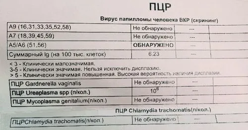 як і чим лікувати уреаплазму