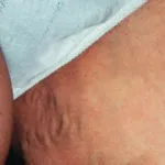 у чоловіків
