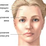 як лікувати невралгію лицьового нерва в домашніх умовах