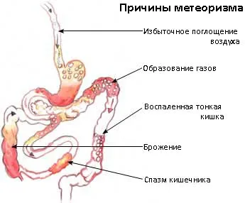 як лікувати печію і здуття живота