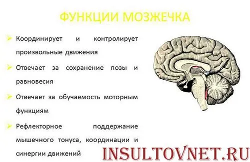 як лікувати інсульт мозочка