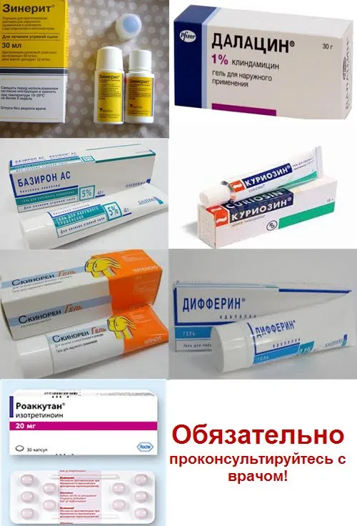як позбутися від прищів на обличчі назавжди за 1 день