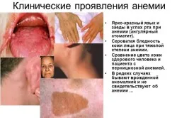 органи кровотворення