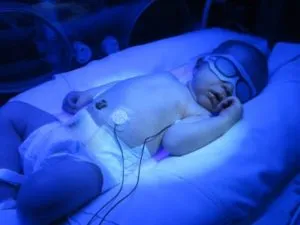 як лікувати патологічну жовтяницю