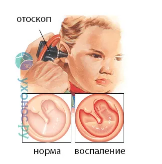 як лікувати дерматит у вусі