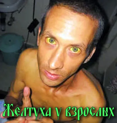 лікування