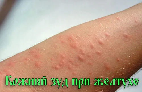 зож