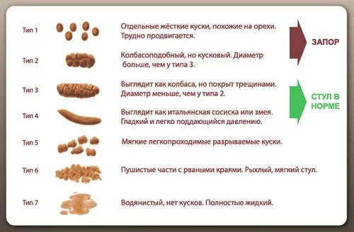 Хронічний запор лікувати хронічний запор
