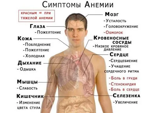 як лікувати анемію у дорослих