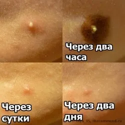 причина