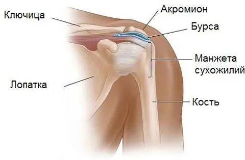 Бурсит: симптоми і причини, лікування і профілактика як лікувати вертельную бурсит