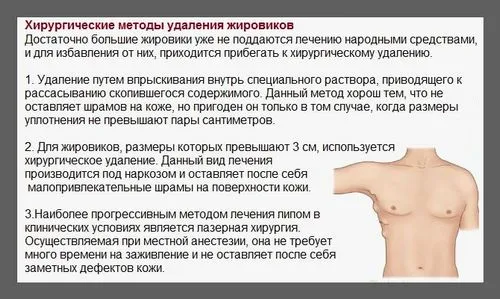 засіб
