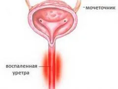 чоловіче здоров'я