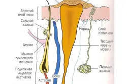 як лікувати сухі мозолі і натоптиші