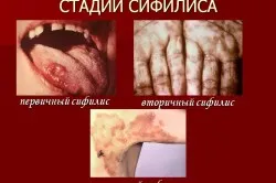 стоп ЗПСШ