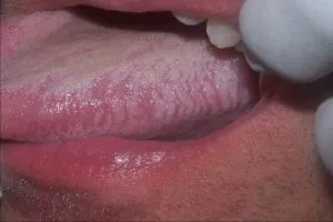 яке