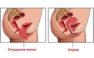 як лікувати виділення сечі