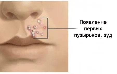 як лікувати стрептодермії на голові