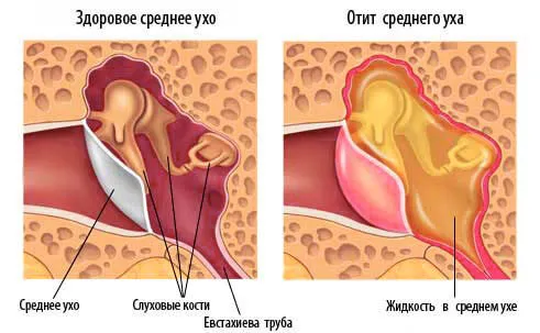 перекис водню