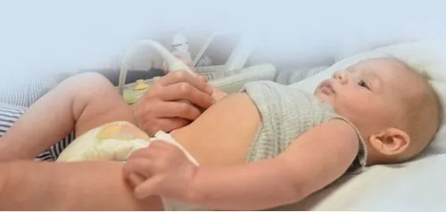 як лікувати подвоєння нирки